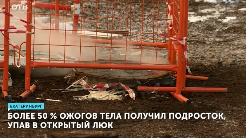 Более 50 % ожогов тела получил подросток, упав в открытый люк