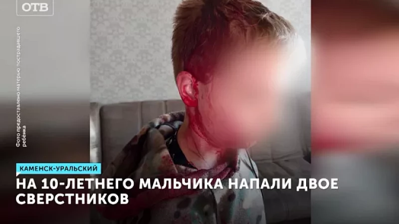На 10-летнего мальчика напали двое сверстников