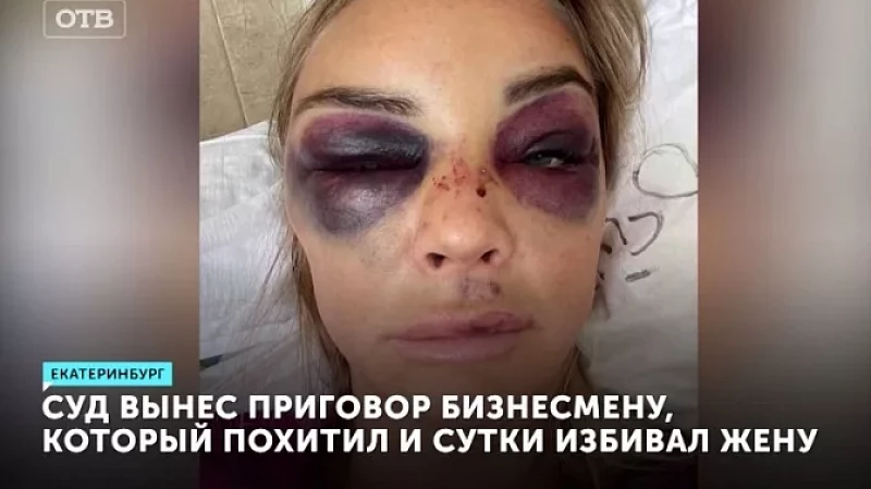 Суд вынес приговор бизнесмену, который похитил и сутки избивал жену