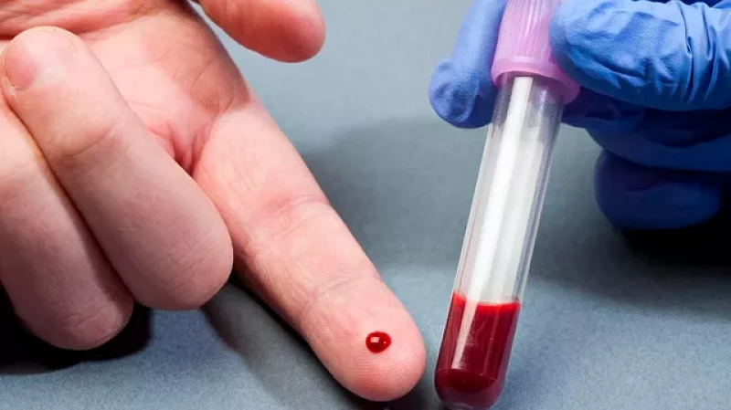 82% россиян знают свою группу крови