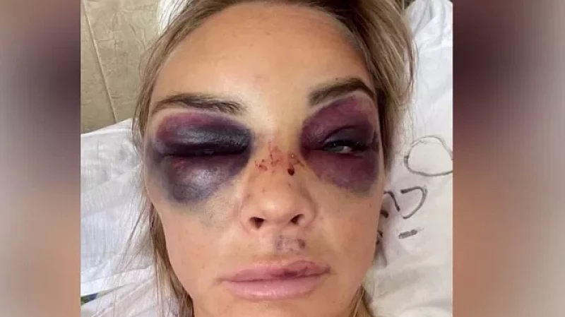 За похищение и избиение жены бизнесмену грозит 12 лет лишения свободы