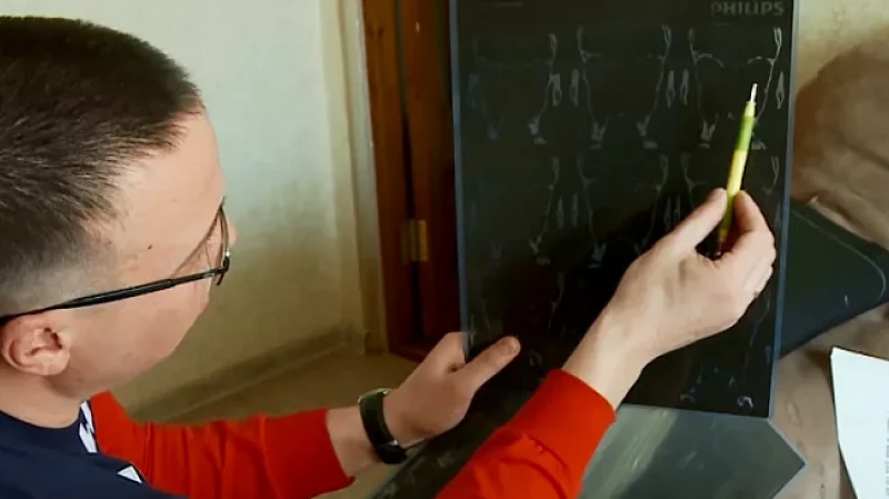 Мужчина слепнет после стычки с охранником ресторана