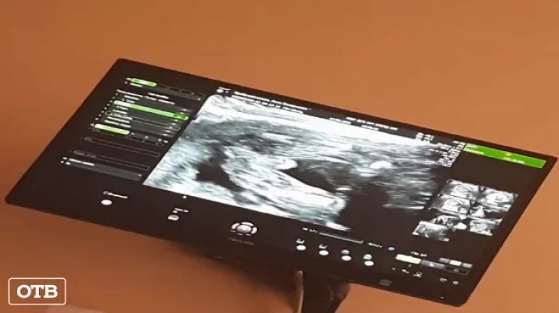 Прерванная жизнь: в Екатеринбурге завели уголовное дело на врачей