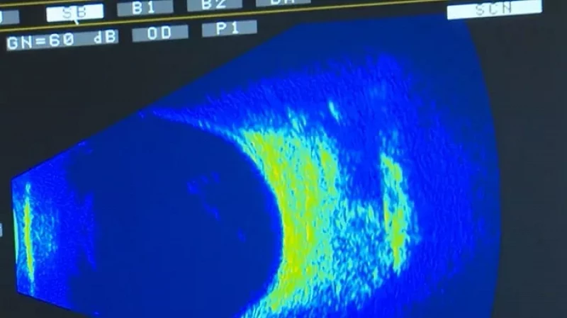 Уникальное офтальмологическое оборудование получил областной госпиталь ветеранов войн