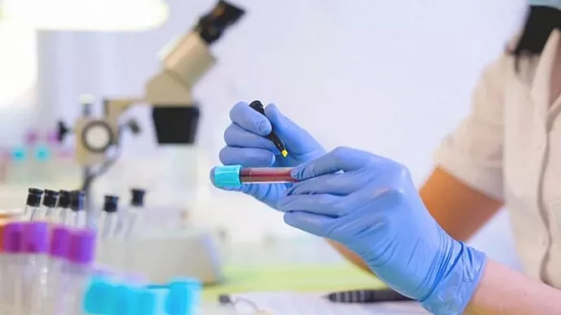 Пониженные нейтрофилы: причины и лечение