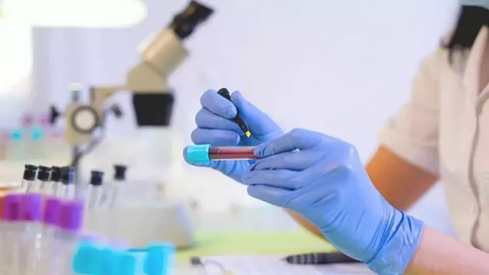 Пониженные нейтрофилы: причины и лечение