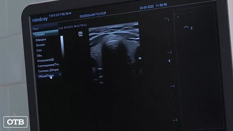 В роддоме ГКБ № 14 Екатеринбурга появился новый аппарат УЗИ экспертного класса