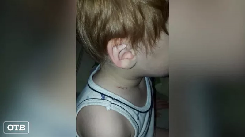 Семье мальчика из Екатеринбурга, которого душили в детском саду, выплатят компенсацию