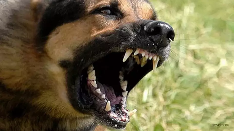 В Нижнем Тагиле собака за лицо покусала 9-летнего ребенка: прокуратура проводит проверку