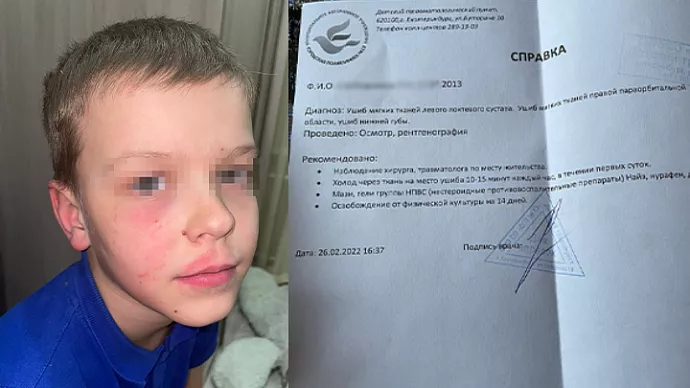 Попал снежком: мужчина избил 8-летнего мальчика в Екатеринбурге