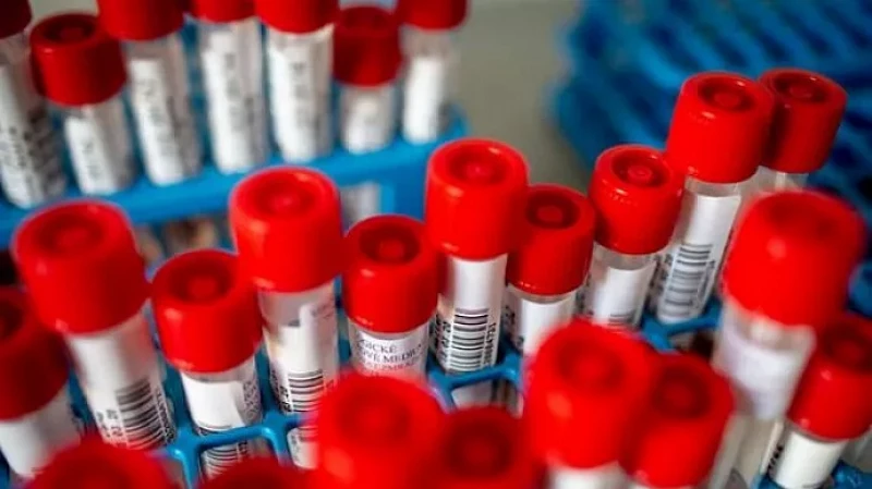 И это ещё не плато: на Среднем Урале выявлено 5904 случаев заболевания COVID-19