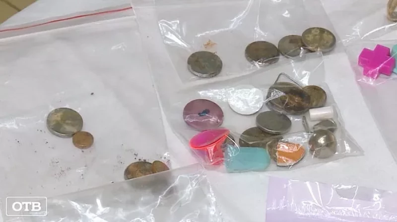 Пуговицы, магниты и монеты: свердловские медики собрали коллекцию вещей, проглоченных детьми