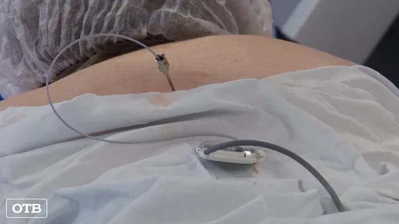 В 40-й больнице пациентам устанавливают нейростимуляторы для спасения от хронической боли