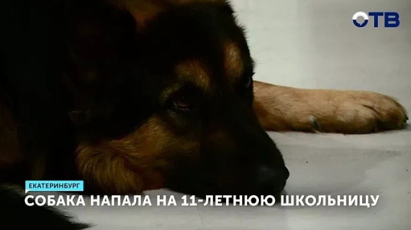 Собака напала на 11-летнюю девочку
