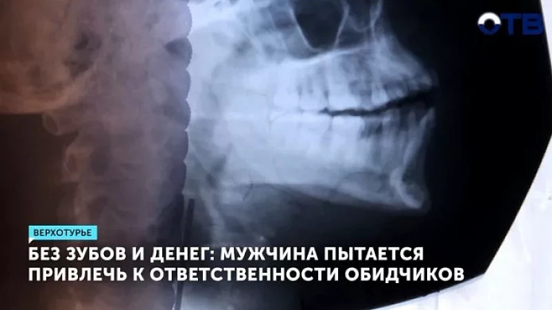 Без зубов и денег: мужчина пытается привлечь к ответственности обидчиков