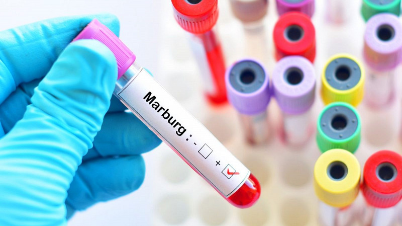 Вирусолог Владимир Неронов: как обезопасить себя от лихорадки Марбурга в России