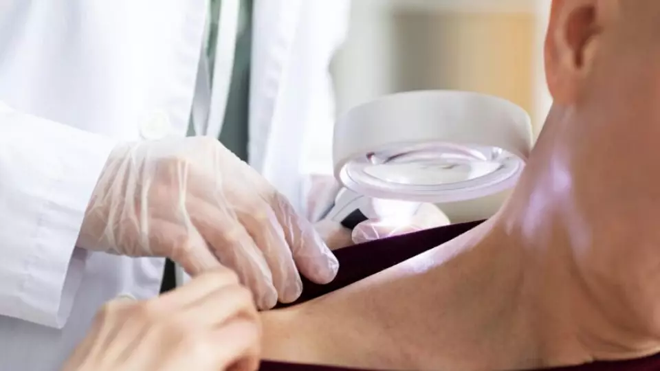 В Свердловской области всплеск сифилиса среди мигрантов