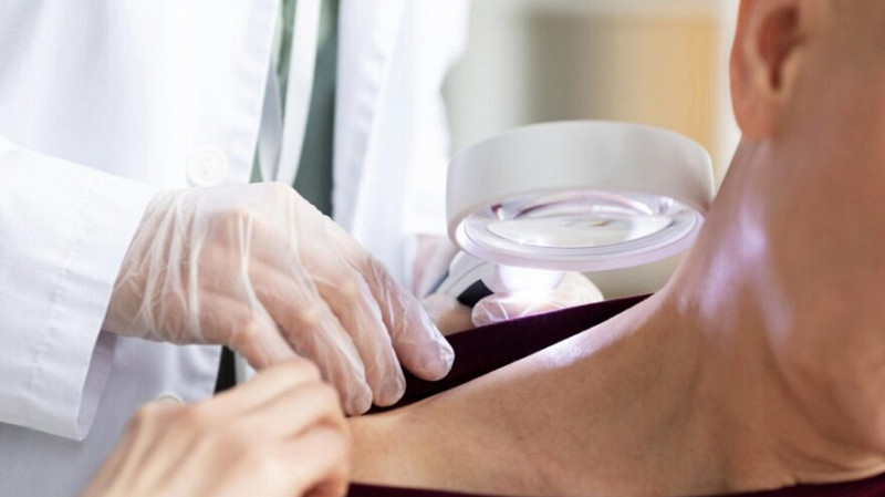 В Свердловской области резко выросли случаи заболеваемости сифилисом