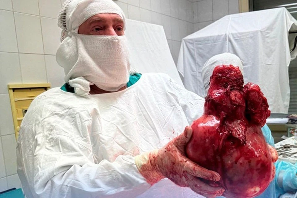 Врачи Сургутской больницы успешно удалили миому весом 5 кг