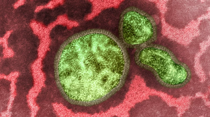 В России растет число случаев гриппа B