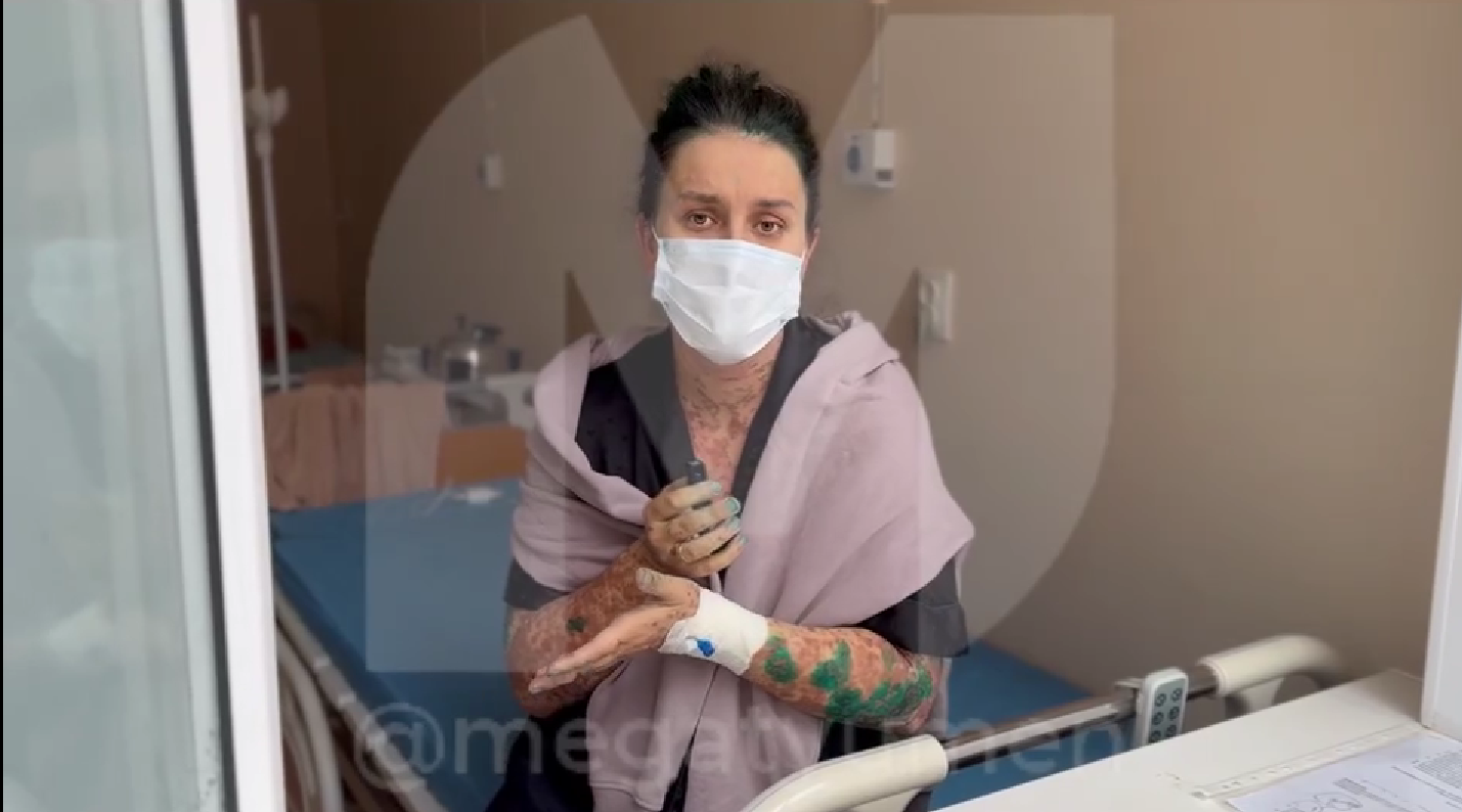 Женщина попала в больницу с сыпью и язвами после приема обезболивающих