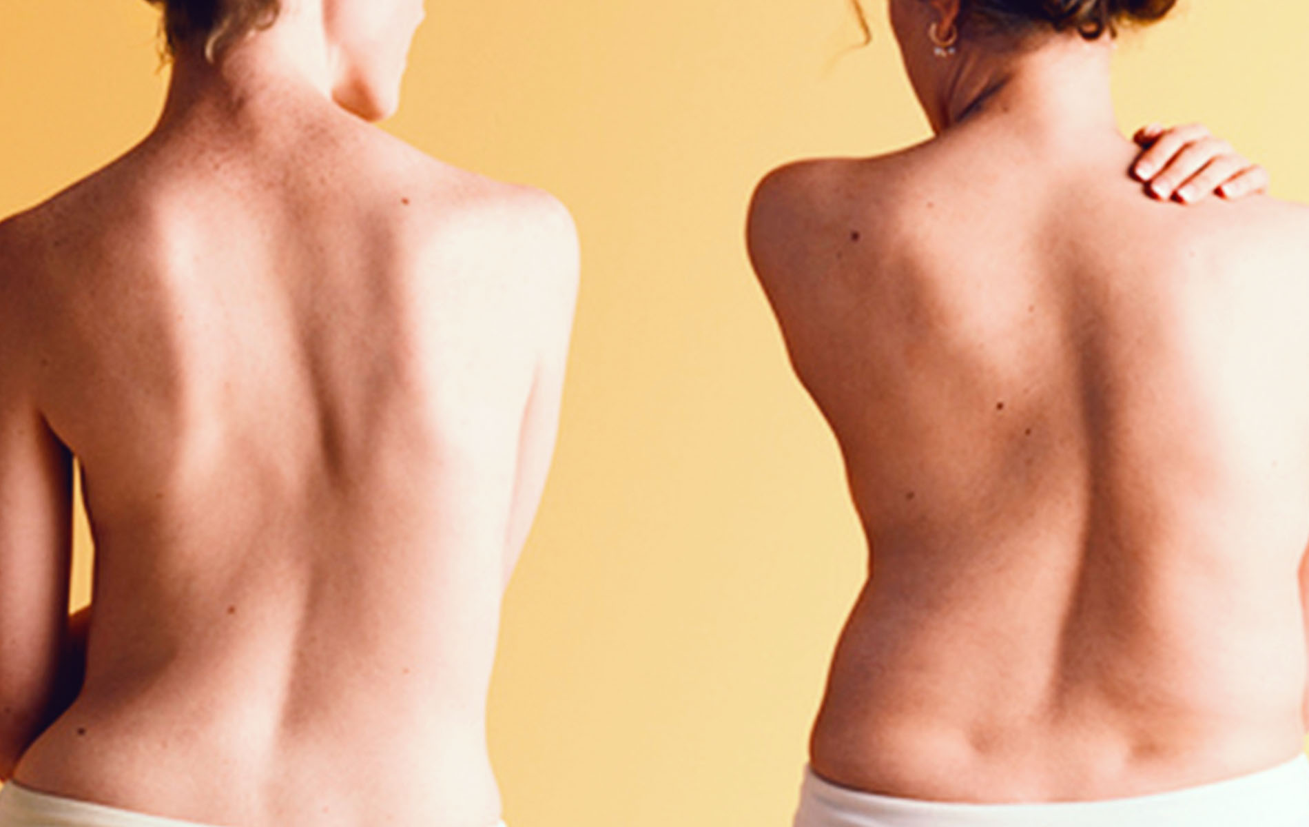 Врач-травматолог предупреждает о рисках сколиоза для здоровья