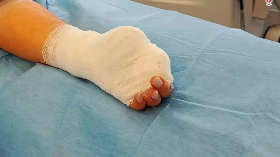 Девушка лишилась пальцев, коснувшись зарядки мокрой рукой