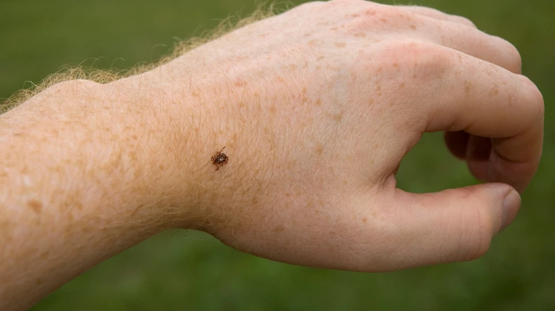 13 человек заразились клещевым энцефалитом в Свердловской области