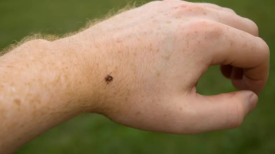 13 человек заразились клещевым энцефалитом в Свердловской области