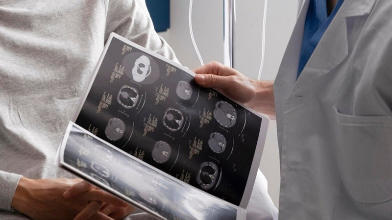 Онколог назвала пять факторов, снижающих риск рака на 20%