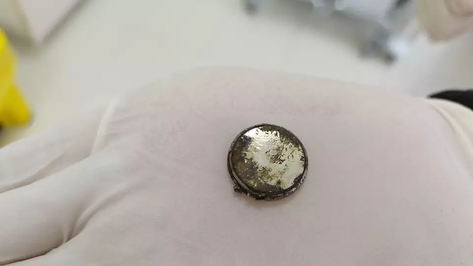 Ребенка, жившего три дня с батарейкой в пищеводе, спасли в Нижневартовске