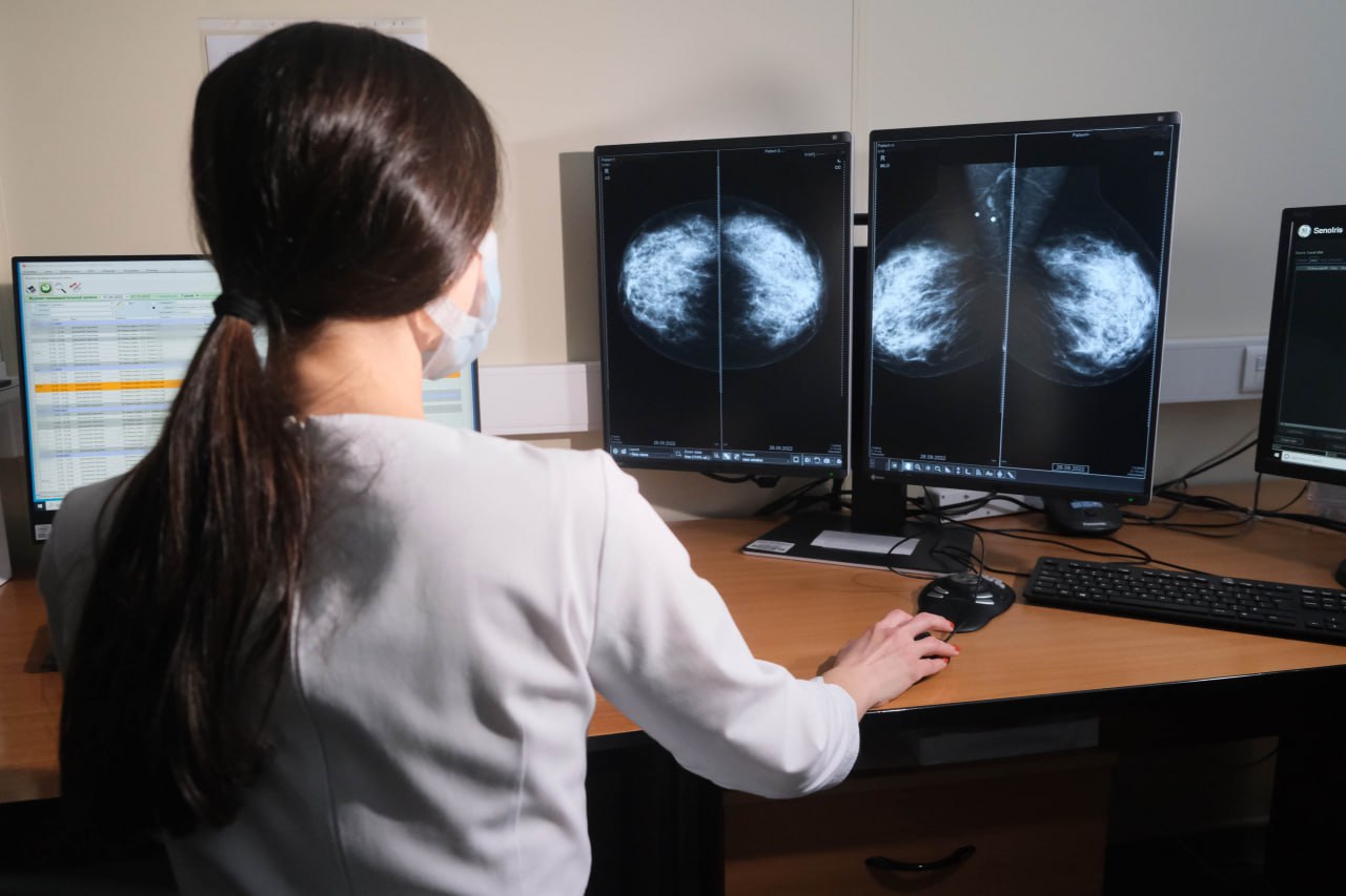 Около 180 тысяч свердловчанок прошли маммографию с начала года