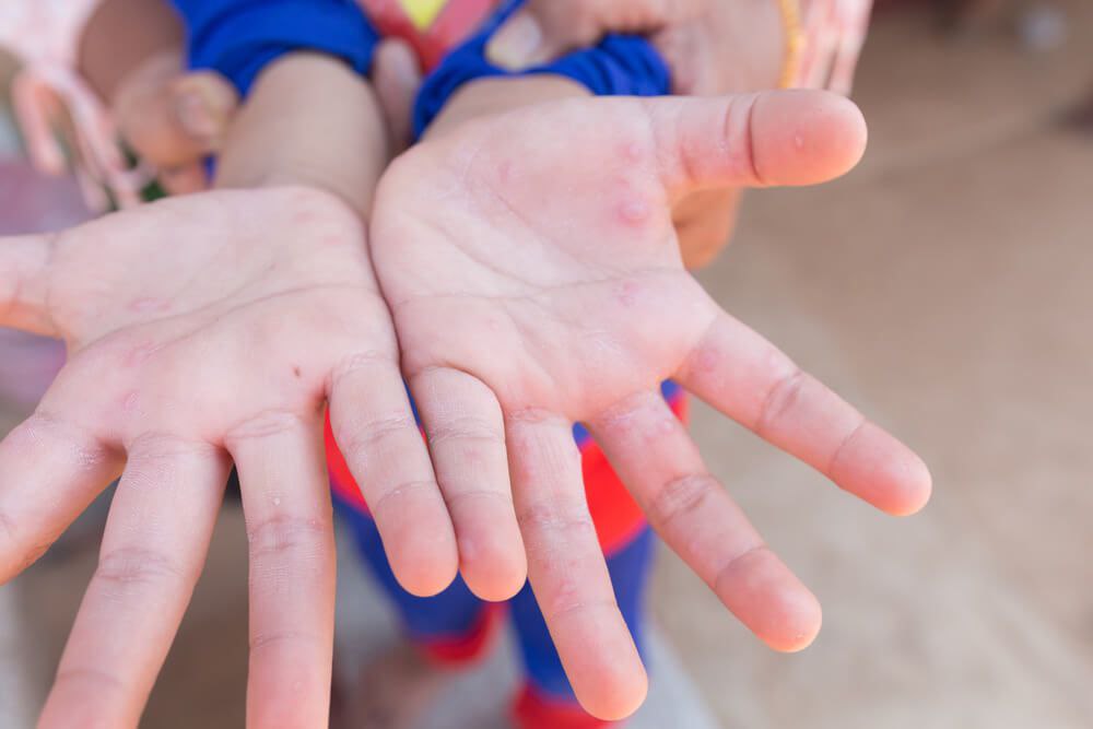 Меры против энтеровируса усилят в свердловских школах и детсадах