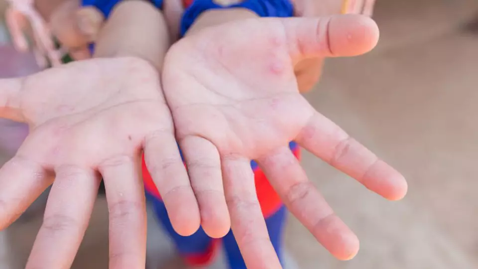 Меры против энтеровируса усилят в свердловских школах и детсадах