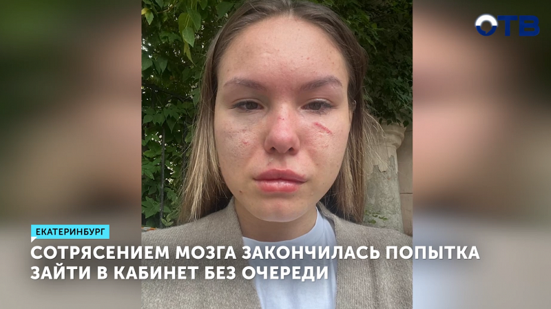 Драка в Екатеринбурге: женщина получила травмы в управлении образования