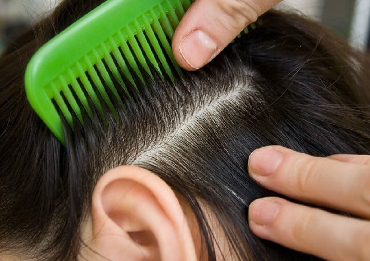 Роспотребнадзор: как бороться с педикулезом