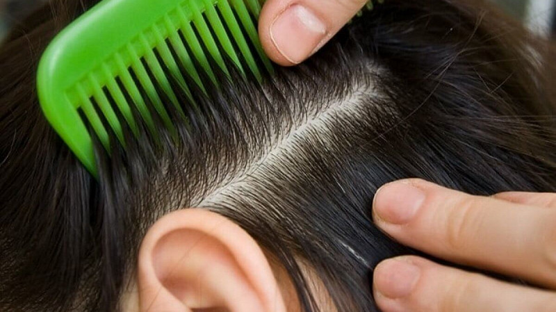 Роспотребнадзор: как бороться с педикулезом