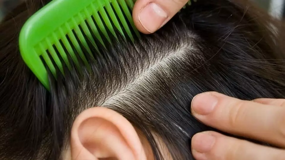 Роспотребнадзор: как бороться с педикулезом