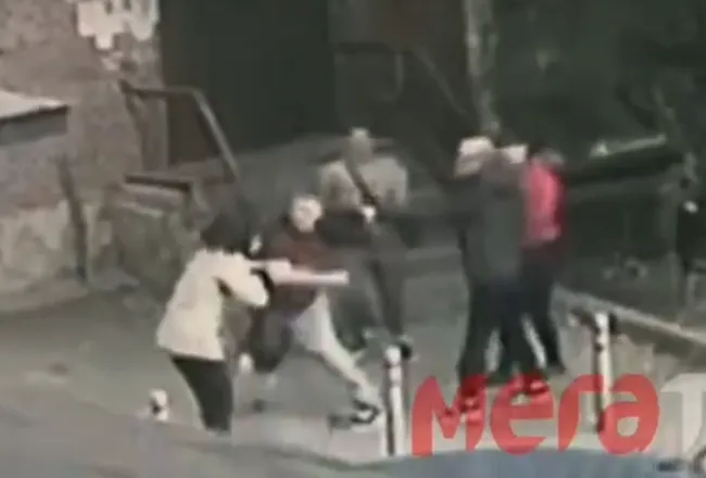 Женщина в Тюмени сломала нос пенсионерке из-за кота