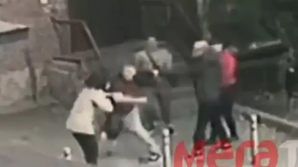 Женщина в Тюмени сломала нос пенсионерке из-за кота