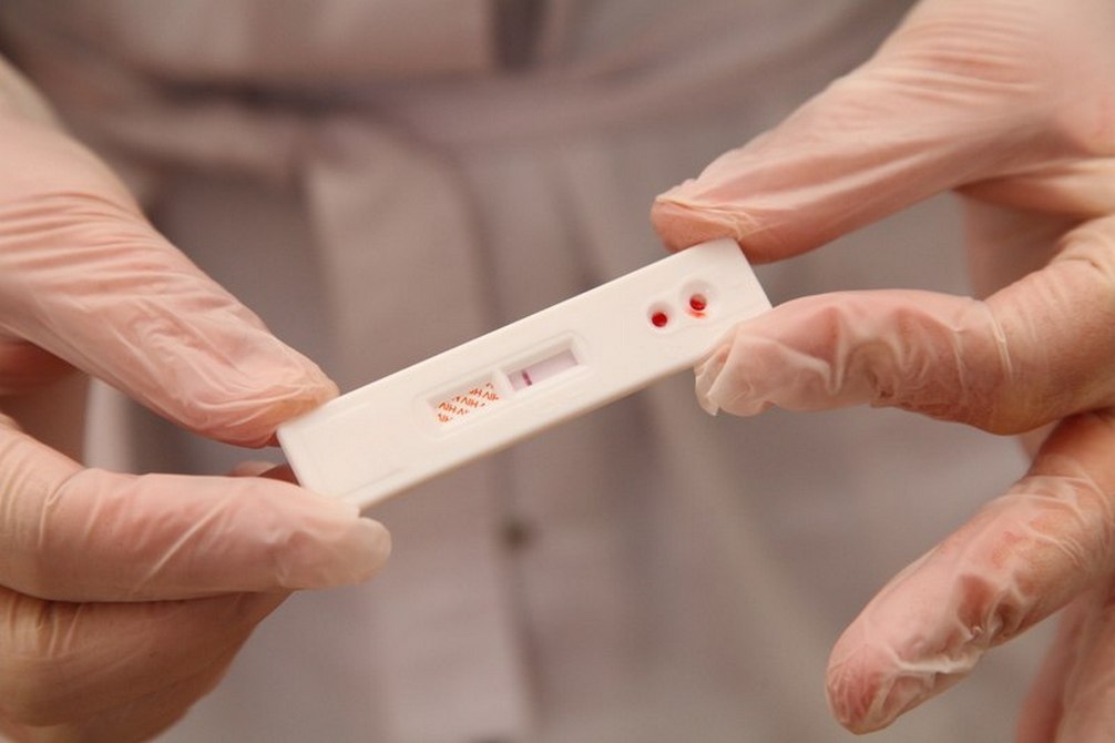 Тест на ВИЧ на работе спас жизнь свердловчанину