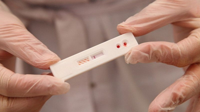 Тест на ВИЧ на работе спас жизнь свердловчанину