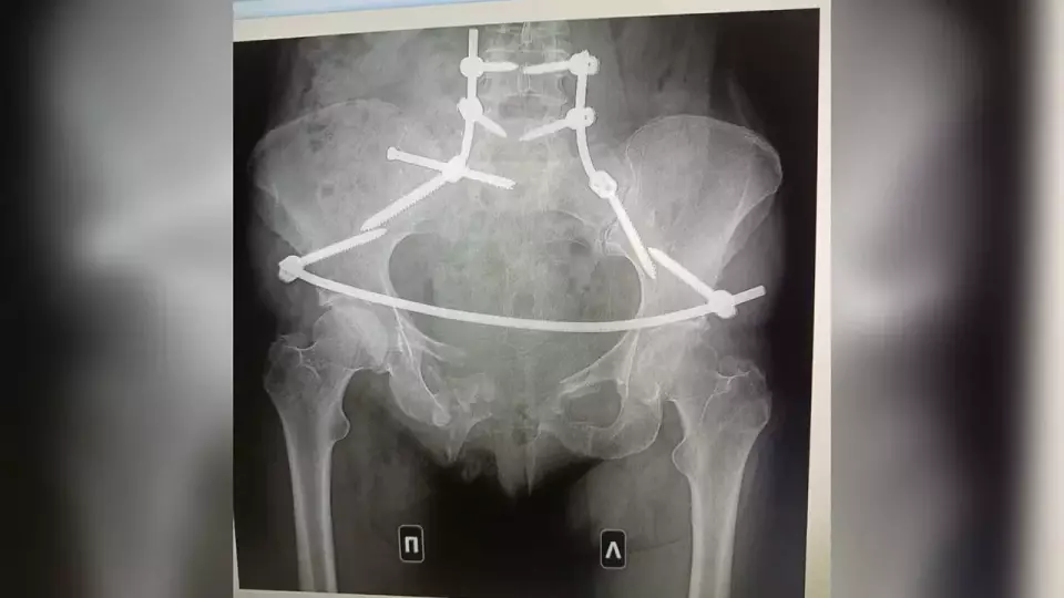 Тюменка, которую переехал сосед, борется за справедливость