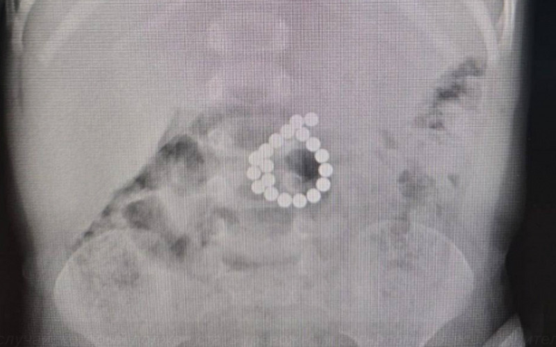 В Югре двухлетний ребенок проглотил 19 магнитов из игрушки и чуть не умер