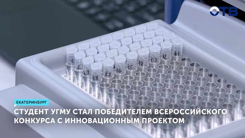 Студент УГМУ выиграл конкурс, разработав тест на рак молочной железы