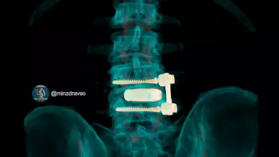 Нейрохирурги восстановили позвоночник 52-летнего водителя скорой помощи