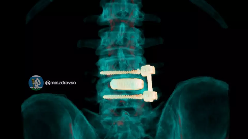 Нейрохирурги восстановили позвоночник 52-летнего водителя скорой помощи