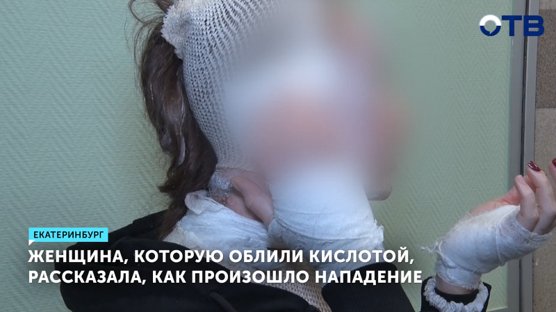 Женщина, которую облили кислотой в Екатеринбурге, рассказала о нападении