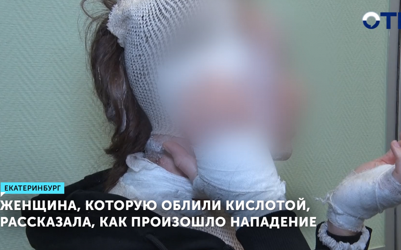 Женщина, которую облили кислотой в Екатеринбурге, рассказала о нападении