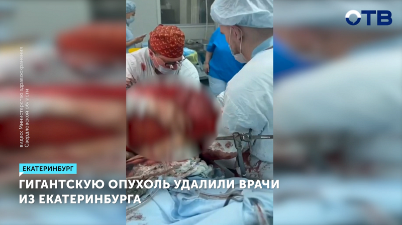 Гигантскую опухоль удалили врачи из Екатеринбурга
